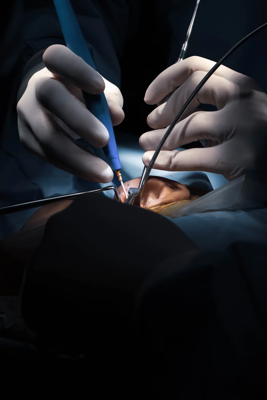 Cirurgia da articulação temporomandibular conduzida pelo Dr. Matheus Dib