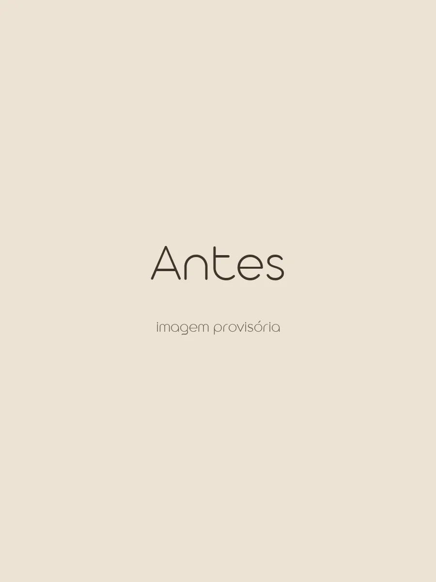 Antes da cirurgia ortognática